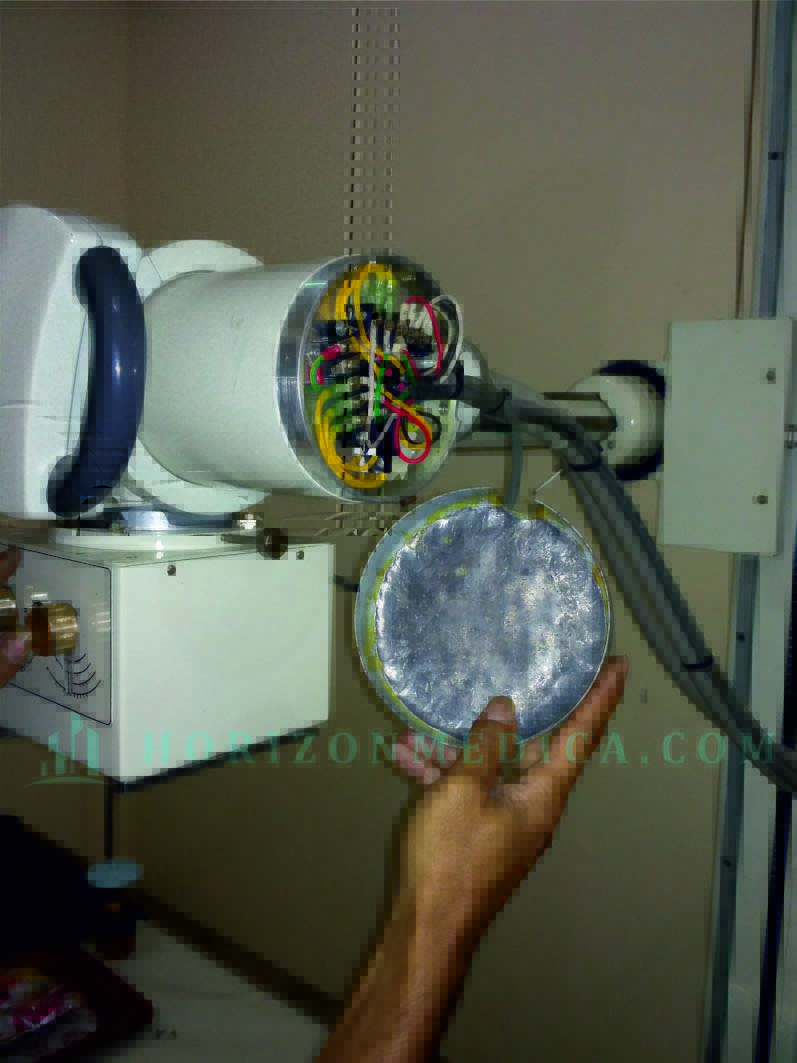 Perbaikan Alat X-Ray Acoma HI 300 - Purworejo
